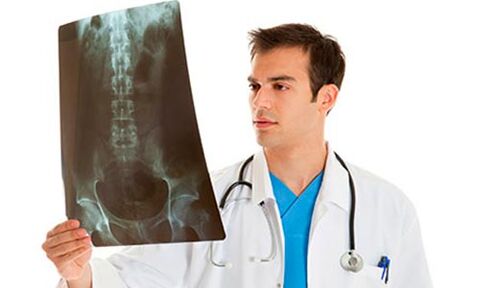 gydytojas apžiūri rentgeno nuotrauką, norėdamas nustatyti juosmens skausmus
